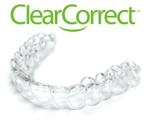 ClearCorrect Braces